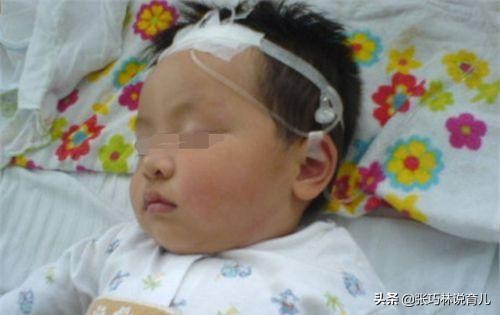 两岁宝宝肺炎支原体感染反复咳嗽,孩子得了支原体肺炎怎么去护理