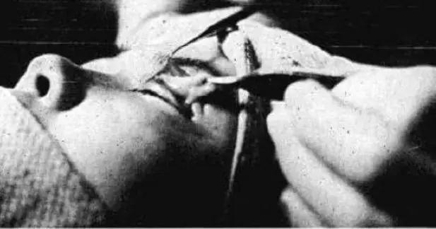 为什么东亚人是浅眼窝,东亚人为什么喜欢皮肤白