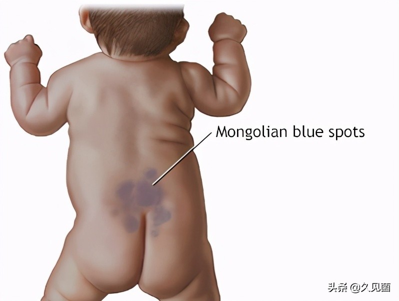 中国人不是“黄种人”？通过肤色划分人种，不亚于“东亚病夫”