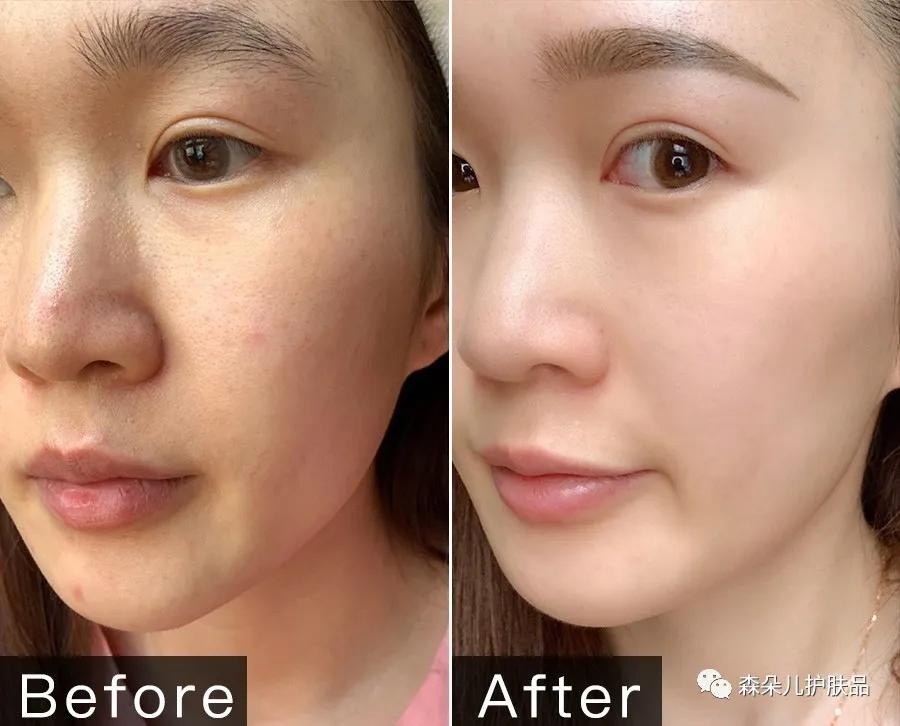 水光急救面膜,大牌好用的急救面膜