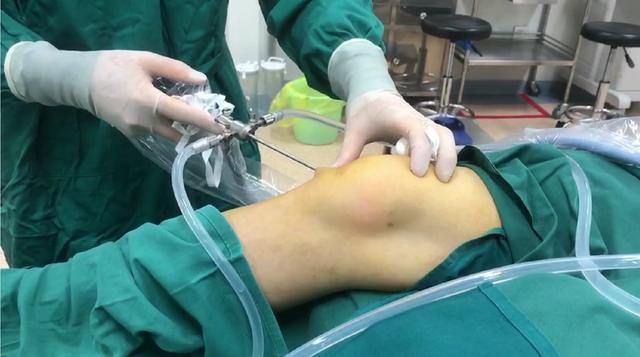 中医治疗类风湿性关节炎中成药,类风湿关节炎中医西医结合方案