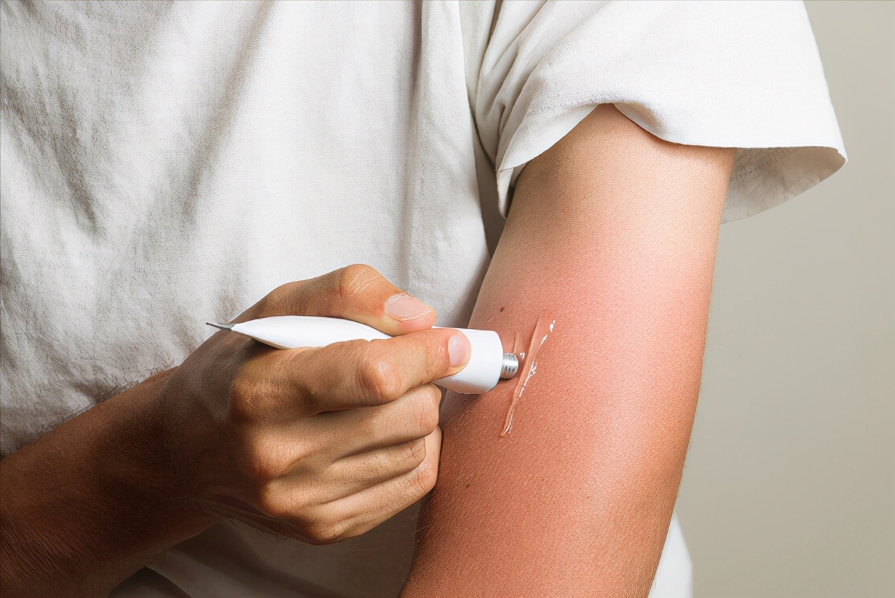 红霉素软膏作用与功效能治脚气吗,2块钱一支的红霉素