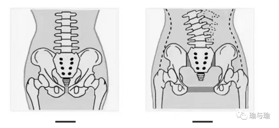 产后一定要做产后修复吗,产后腰痛做产后修复能好吗