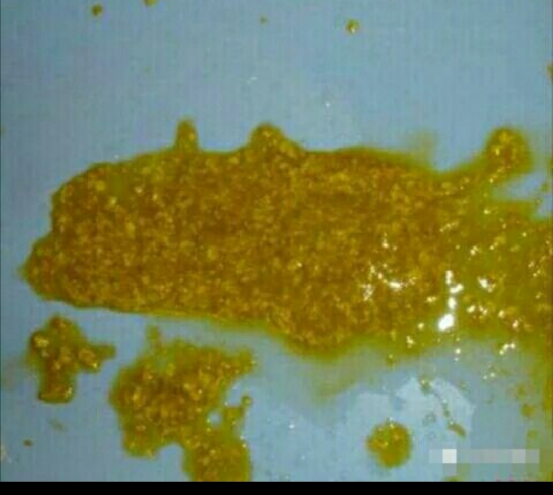 轮状病毒腹泻先呕吐还是先腹泻,轮状病毒孩子呕吐严重怎么处理