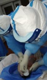 孕妇确诊新冠肺炎怎么缓解,孕妇得新冠肺炎孩子有影响吗