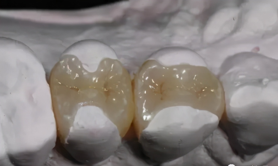 牙齿残根不疼不拔好吗,牙齿残根不疼