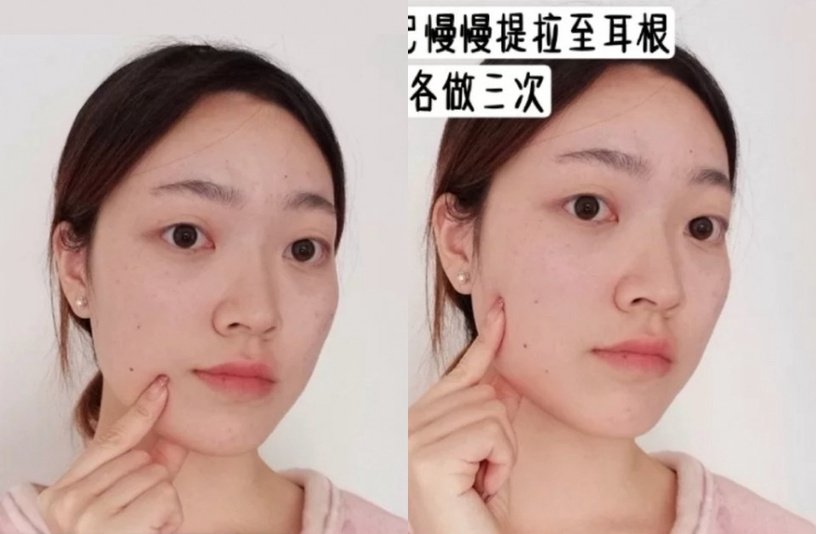 法令纹怎么改善瘦脸,法令纹改善手法