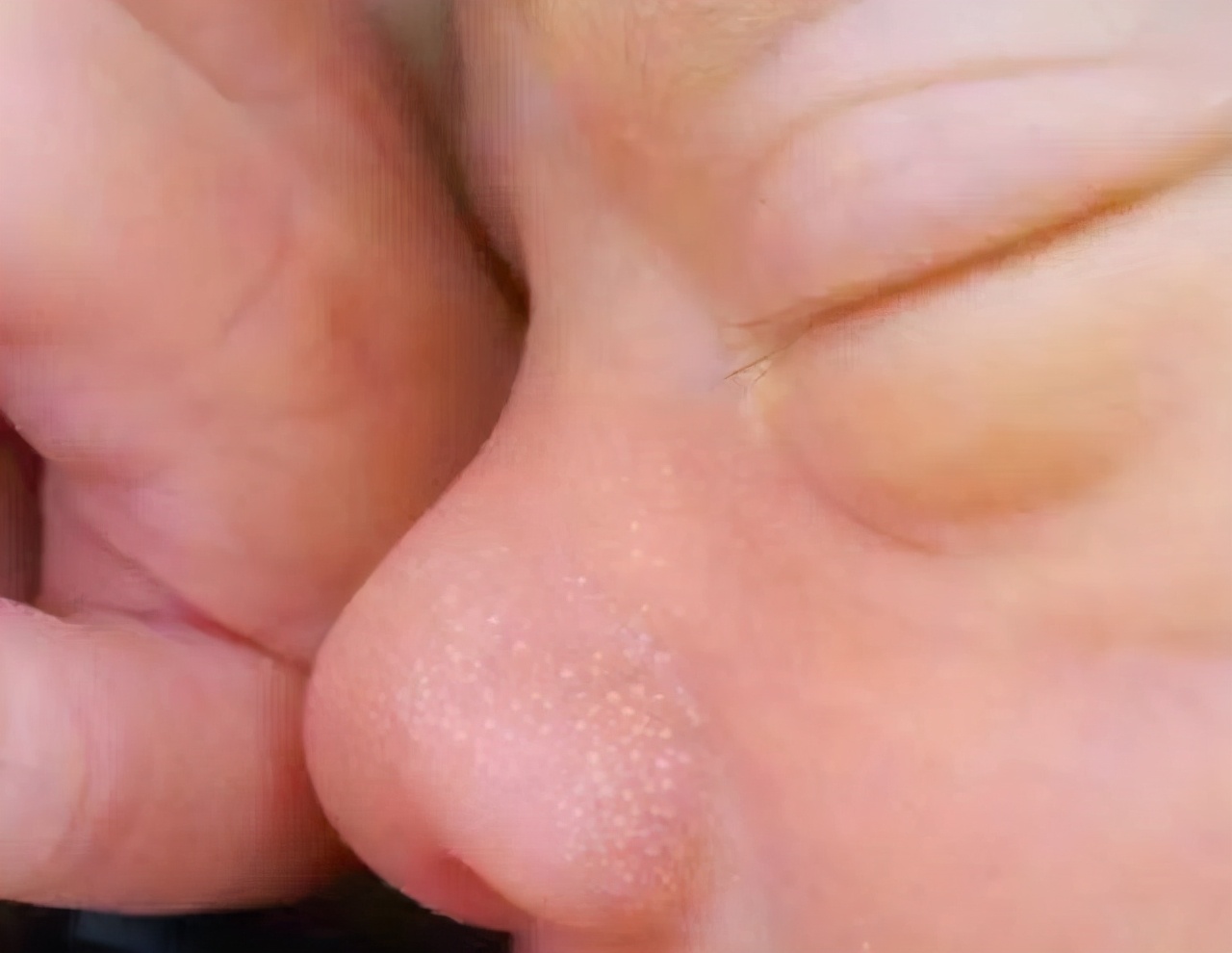 新生儿常见生理现象及护理方式,新生儿生理黄疸现象