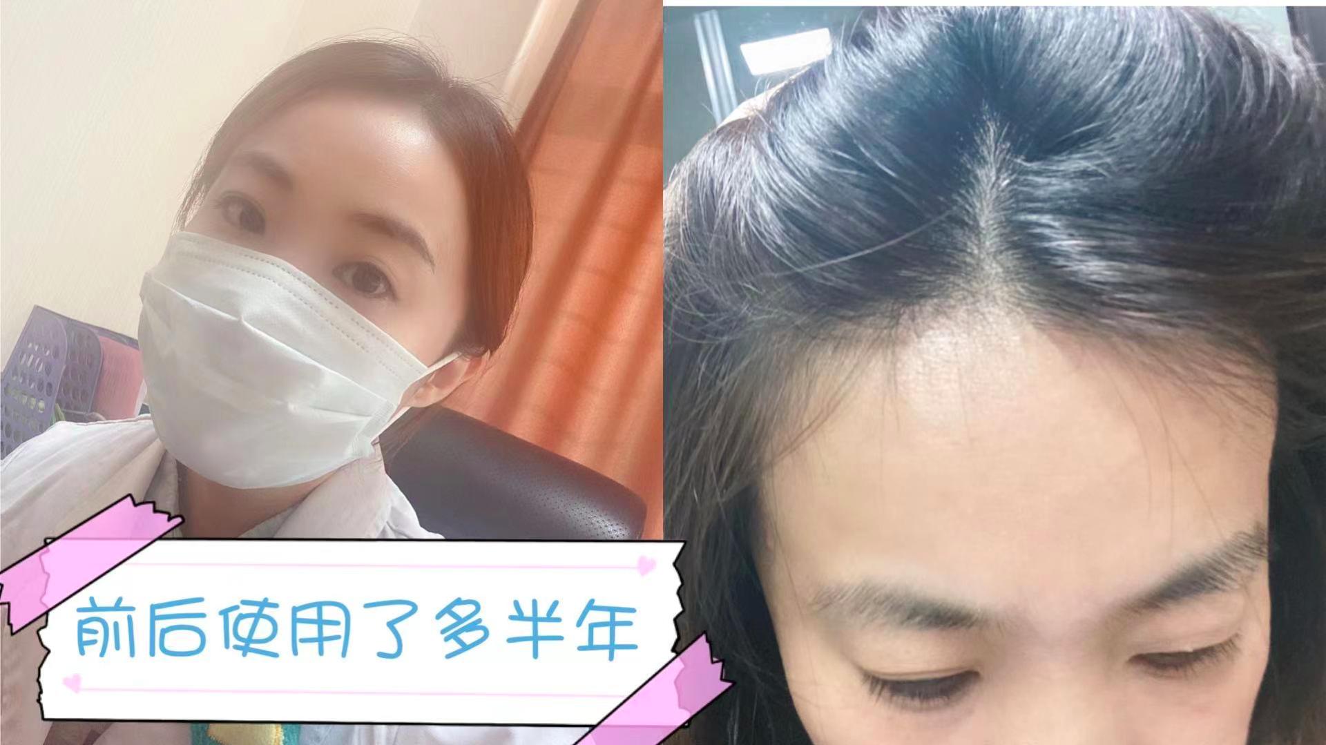 小宝宝脱发严重怎么办,拯救脱发小宝贝