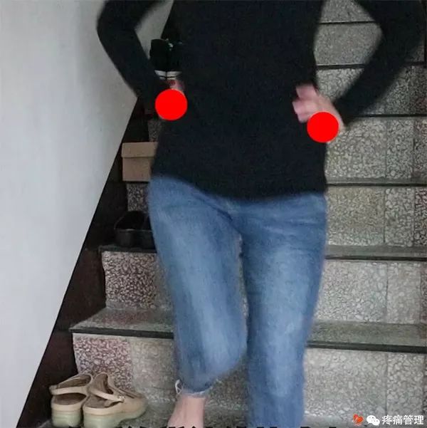 走路屁股扭来扭去是种病，还会导致腰痛、脚痛