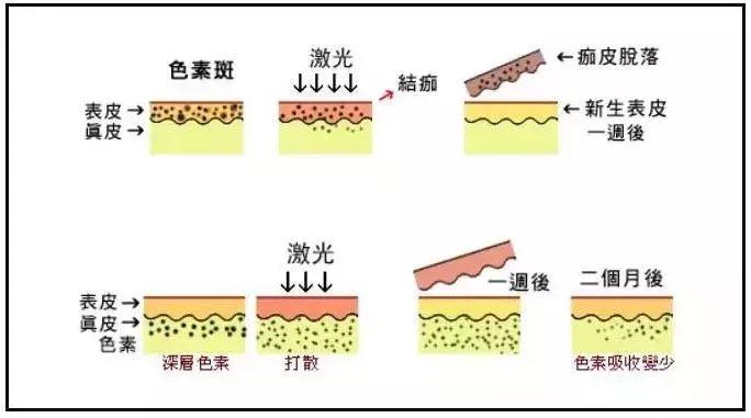 十年光学美容仪,初学者应该怎么选择美容仪