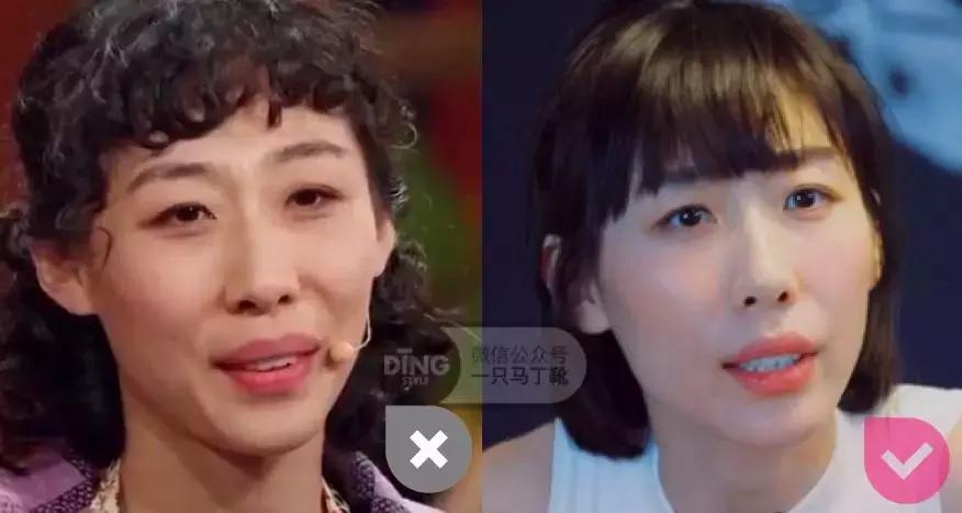 中庭短显年轻还是显老,中庭长怎么避免显老