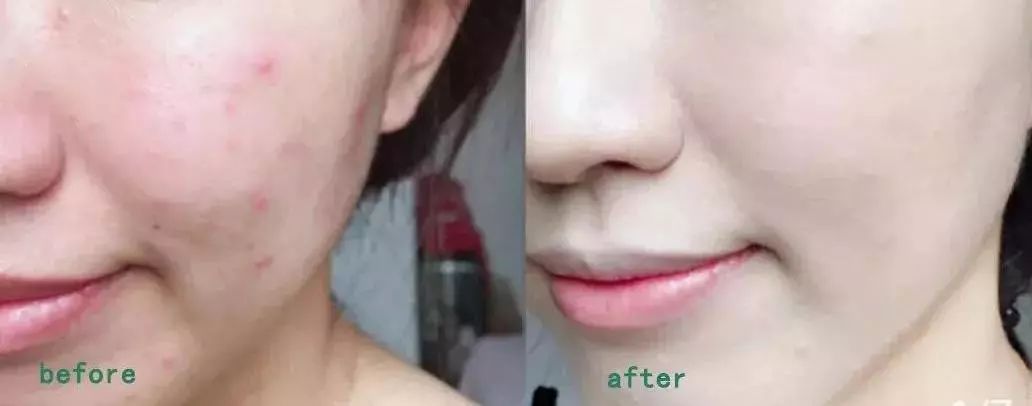 世界十大最好bb霜推荐,世界顶级品牌bb霜