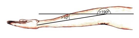 俯卧撑怎么发力手腕不受伤,俯卧撑手腕伤了怎么治