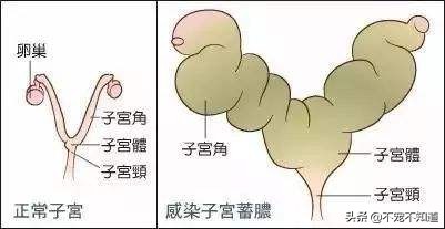 狗狗一般多大会得子宫蓄脓,狗狗得了子宫蓄脓走不稳