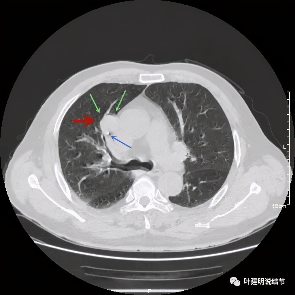 误诊报告图片,误诊案例及案例分析