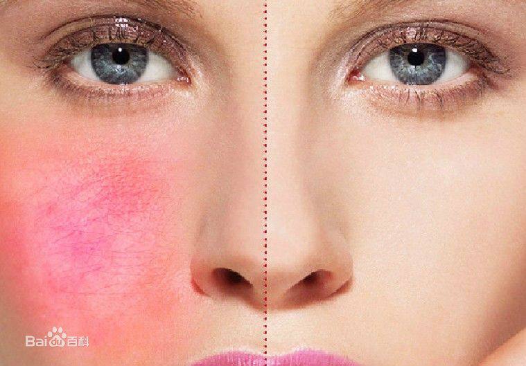 摘掉口罩瞬间毁颜值,摘下口罩的瞬间你有没有吓到