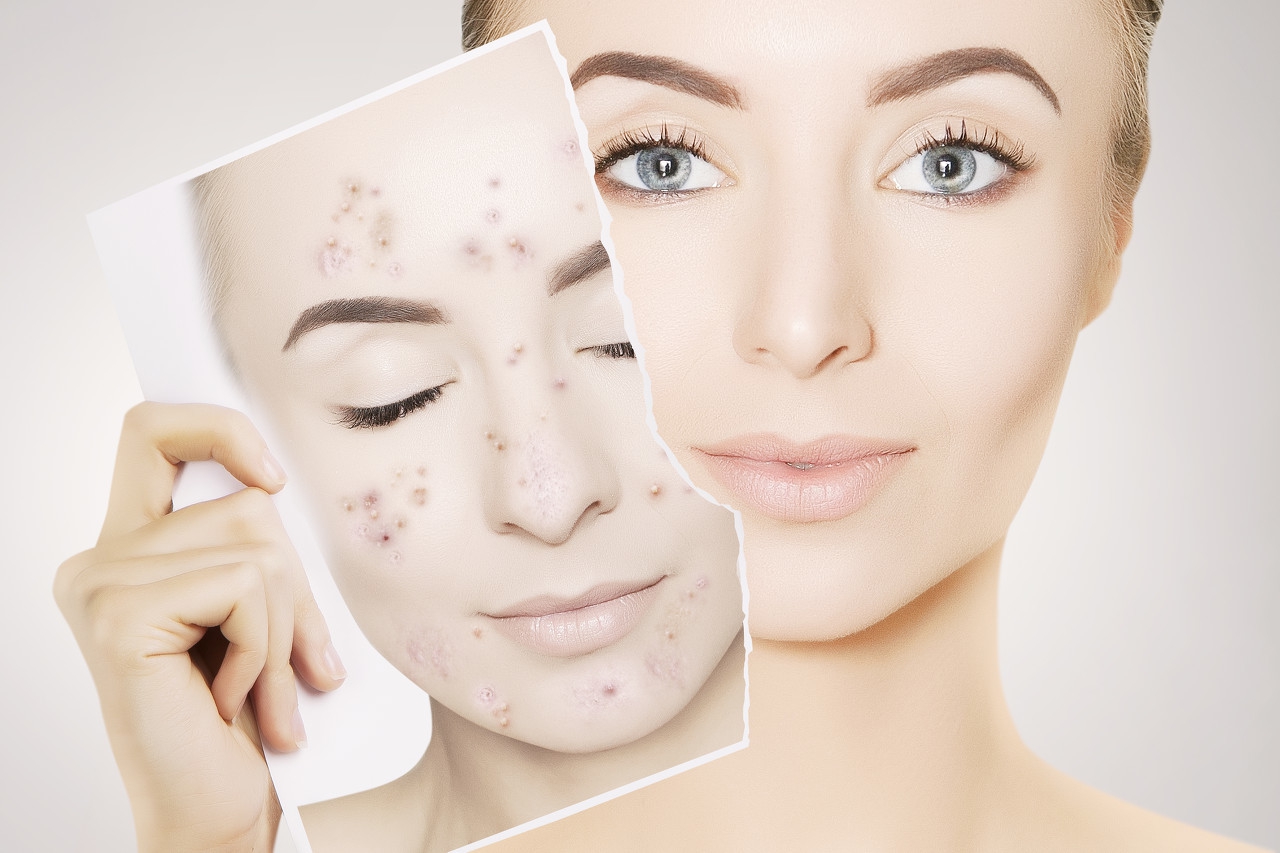 肤色不均匀怎么改善用什么护肤品,肤色不匀怎么改善视频