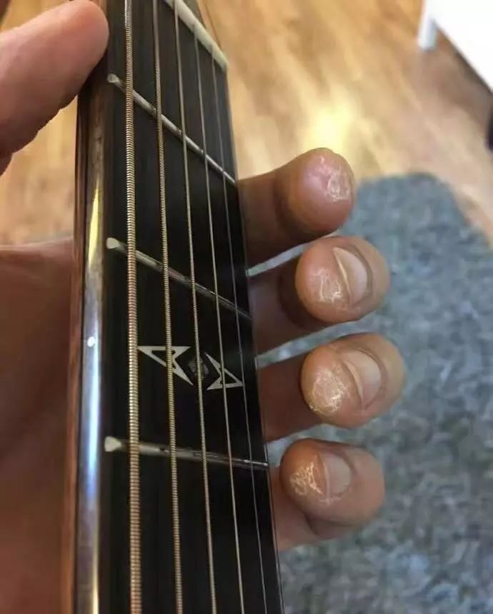 再继续这样弹琴,你的手就要“烂了”