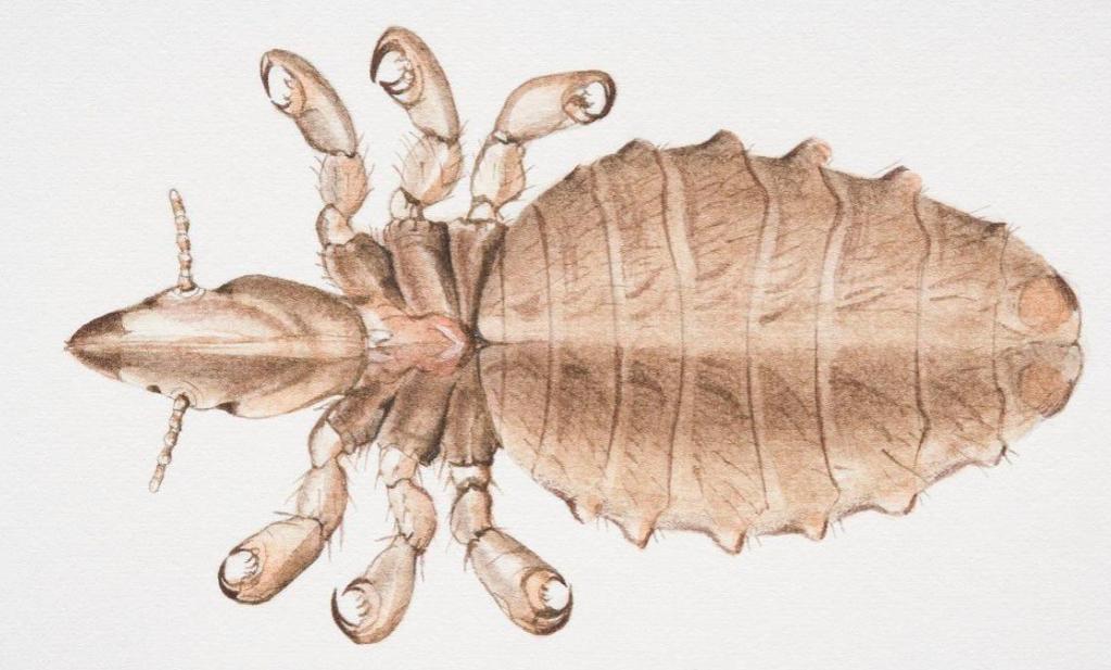 30年前人人身上都有的虱子,30年前人人都有虱子为啥现在消失