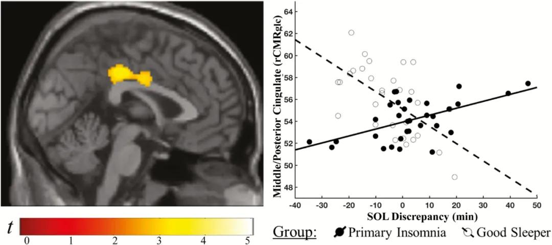 很多失眠的人,有多少人失眠睡不着