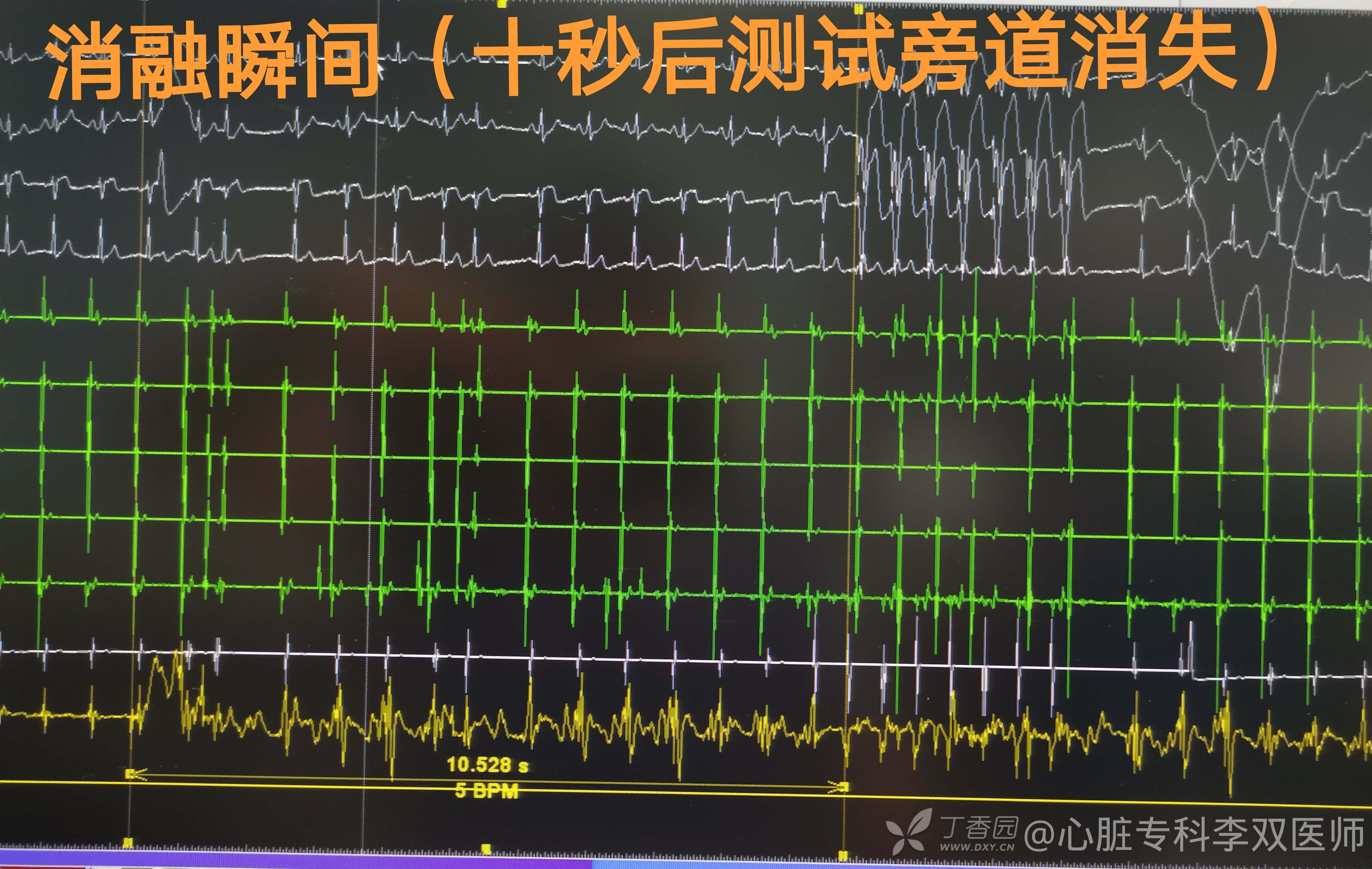 缁欒繙鍦ㄤ粬涔＄殑缃戝弸鎯呬功,缁欒繙鍦ㄤ粬涔＄殑缃戝弸瀵勪粈涔堢ぜ鐗╁ソ