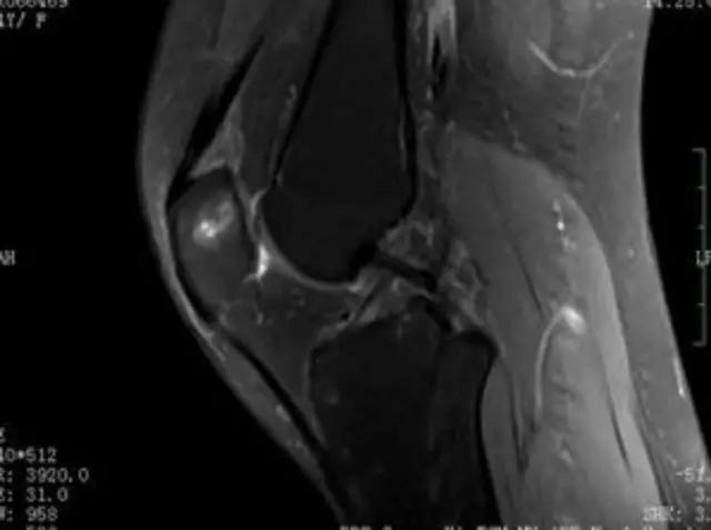 mri临床医师必读电子书,临床医生如何读mri