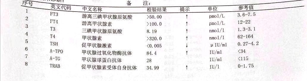 甲亢引起的眼球突出多久能恢复,甲亢导致眼球突出四五年了