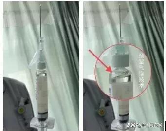 皮下注射没排气会怎样,皮下注射不捏皮肤可以吗