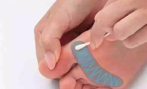 一个小妙招全身的痛都能治,一根棉签的效果视频