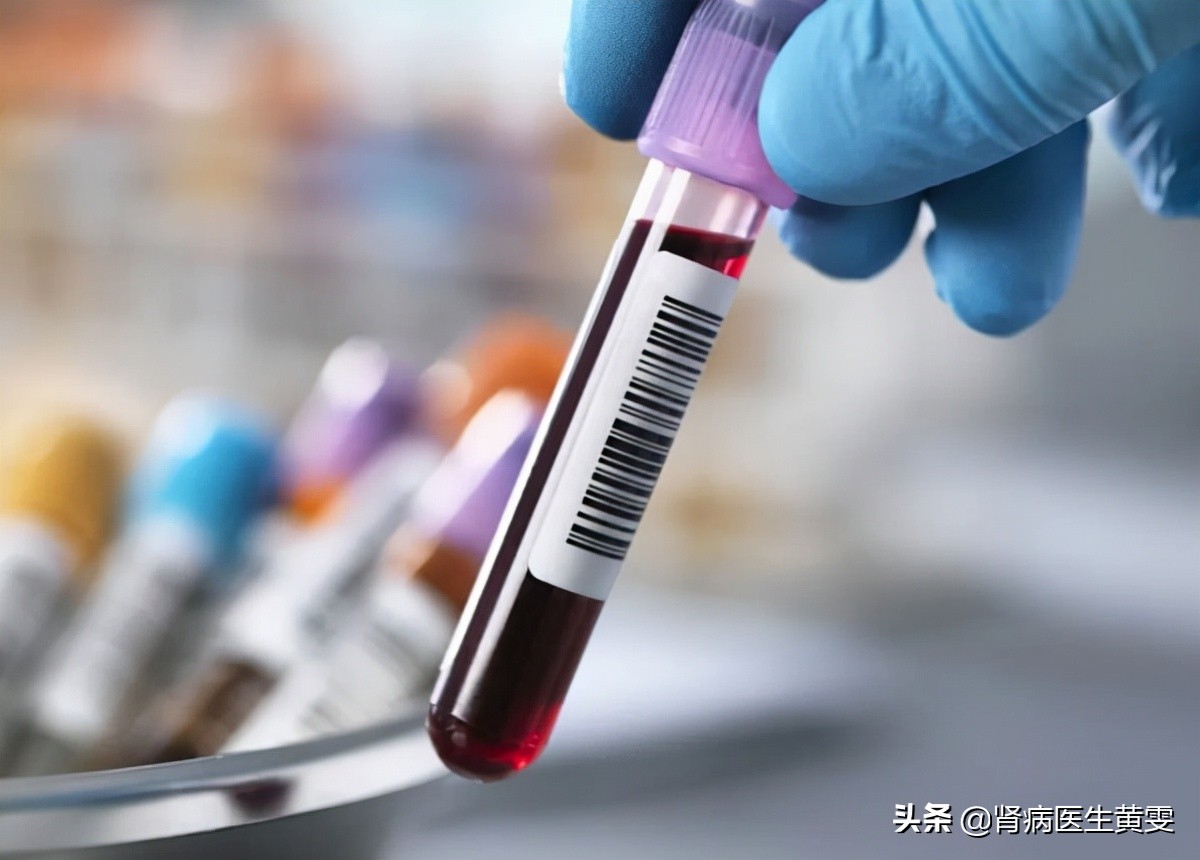 肾病肌酐900为啥不透析？中西医用药降肌酐，这些方法稳定肾功能