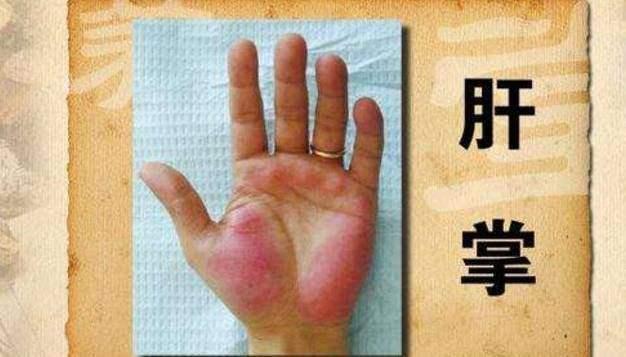 四个征兆暗示你的肝脏好转,这些症状要警惕肝脏病