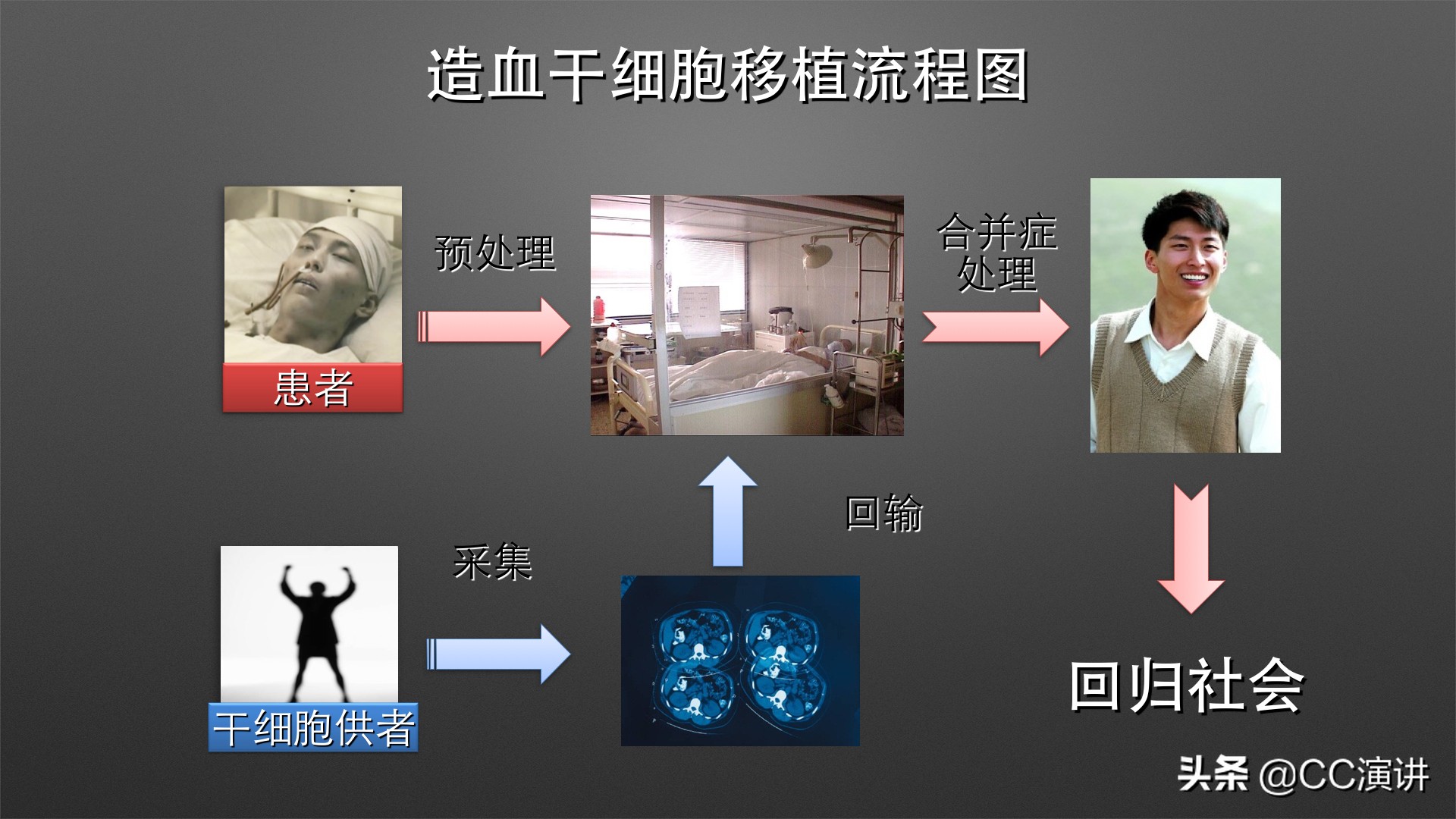白血病不是不治之症单倍体移植如何破解白血病难题?