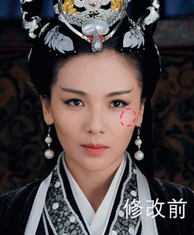 颧弓高脸型怎么改善,有泪沟可以通过调整脸型改善嘛