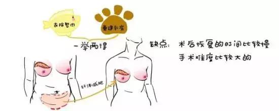 乳房肿块和纤维腺瘤,乳腺纤维腺瘤肿块有无血流信号