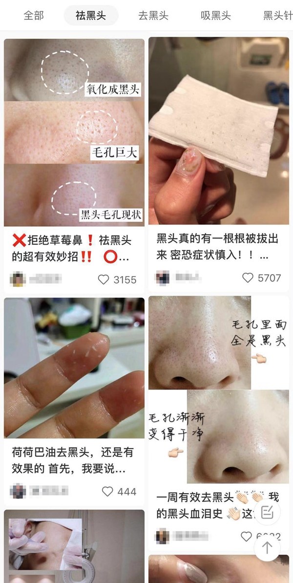 鼻子上黑头越挤越多怎么办,鼻子上黑头越来越多怎么能除去啊