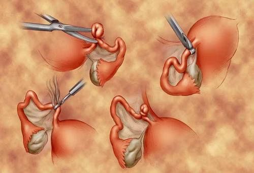 女儿出月子再次住院，老丈人知情后，直怼女婿：还要脸不？