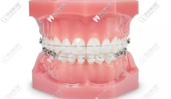 乌鲁木齐美奥口腔医院靠谱么,乌鲁木齐天山区美奥口腔