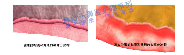 路边的鼻炎馆靠谱吗,路边的鼻炎馆怎么那么贵