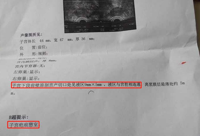 经期延长一般吃什么药好得快,经期延长吃了止血药没用咋办