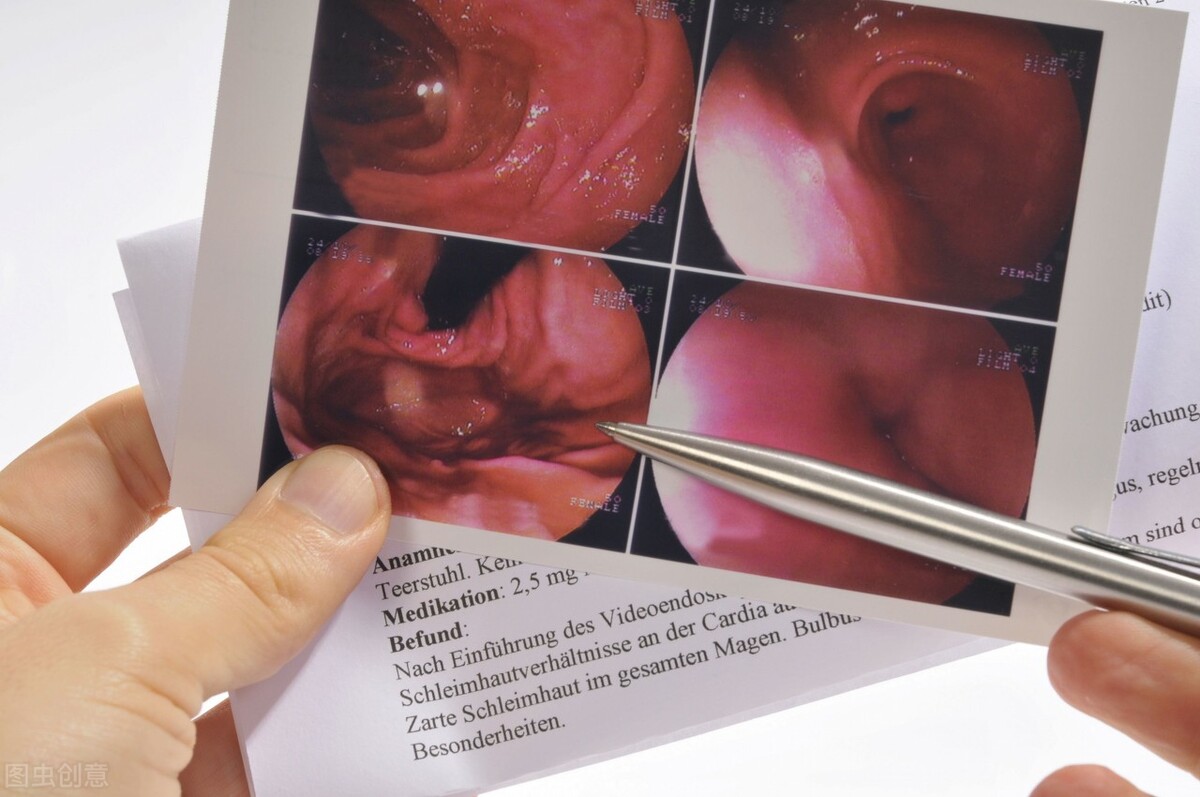 普通胃镜无痛胃镜胶囊胃镜区别,普通胃镜和无痛胃镜检查有何区别