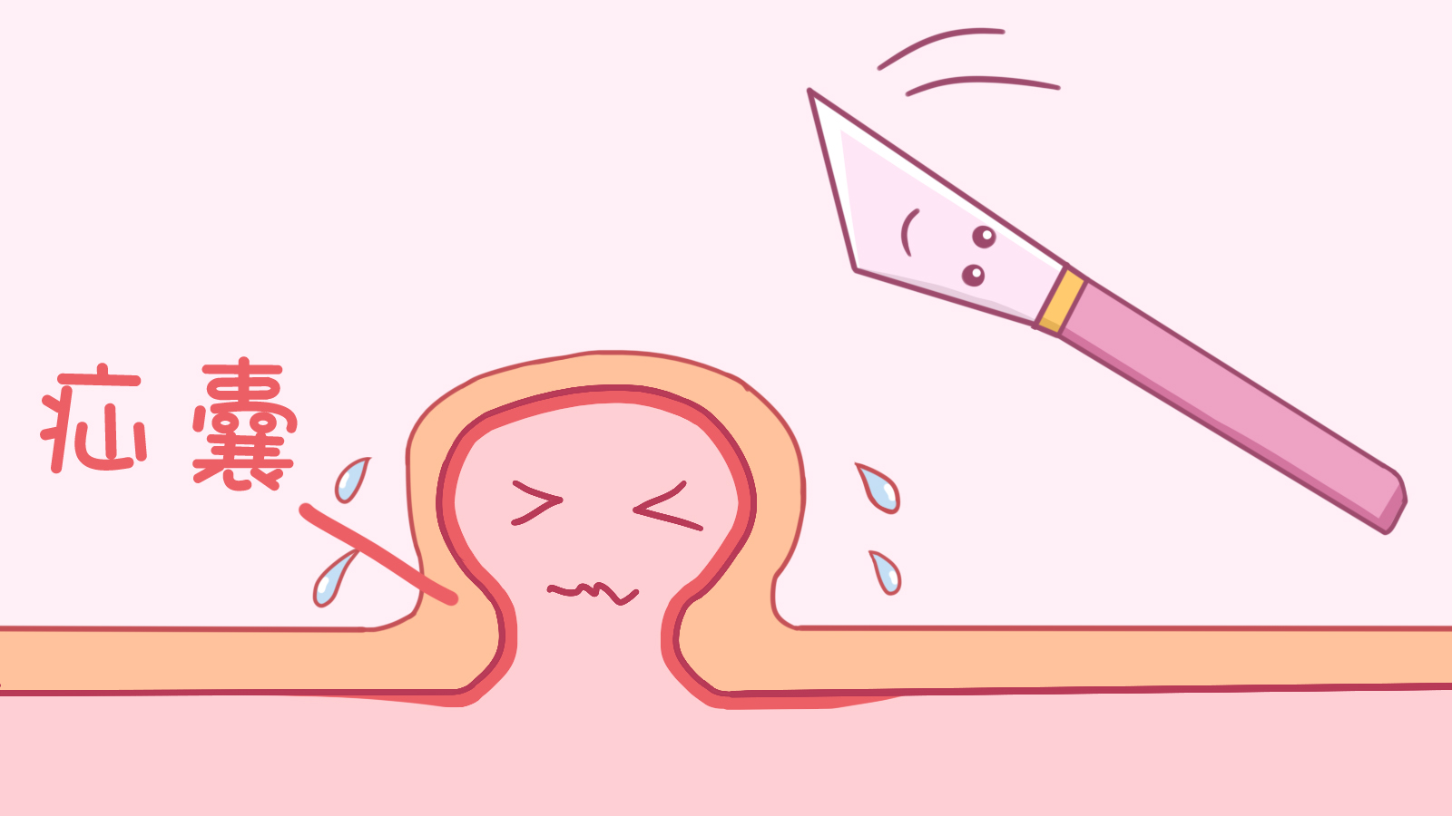 儿童小肠气中医能否治愈,治疗小肠气最快办法