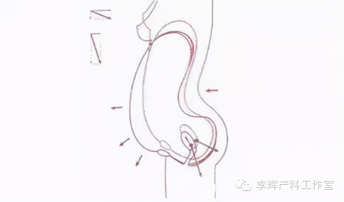 顺产后42天复查建议盆底康复治疗,产后42天复查医生要求做盆底康复