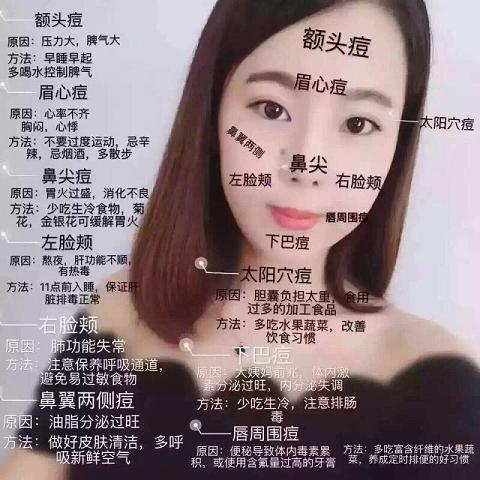 皇家雨燕教你痘痘肌の正确保养方式