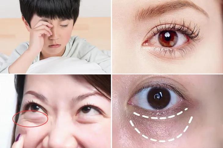 眼部保养重在“润”，用它一喷好舒服！细纹都慢慢膨了起来