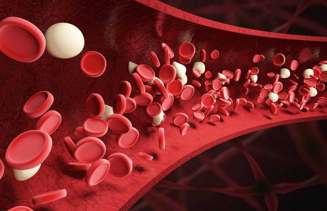 婴幼儿贫血常见病因,婴儿缺铁性贫血病因