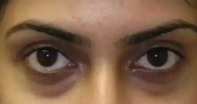 怎么挑选一款适合的眼霜,怎么选择一款适合自己的眼霜