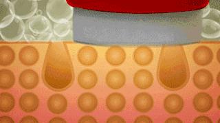 宁静皮肤怎么变白了,为什么明星的皮肤是光滑的