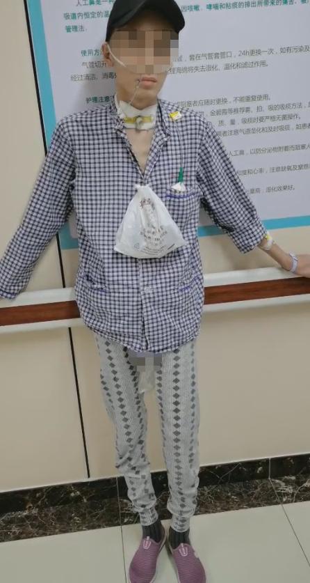 开颅手术后颅内细菌感染图片,外伤开颅手术后脑积液能恢复吗