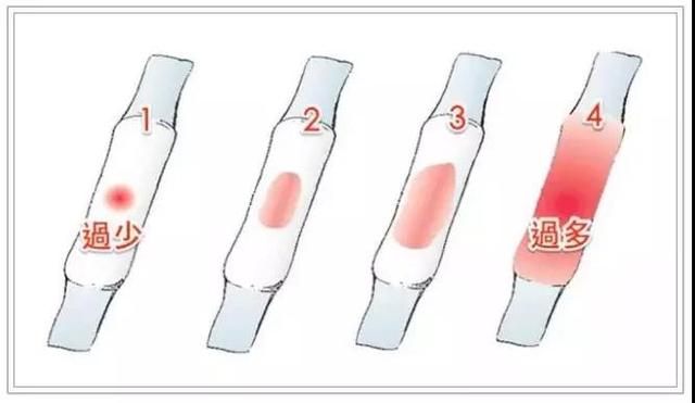 月经量怎么判断过多还是过少,月经量少怎么判断类型